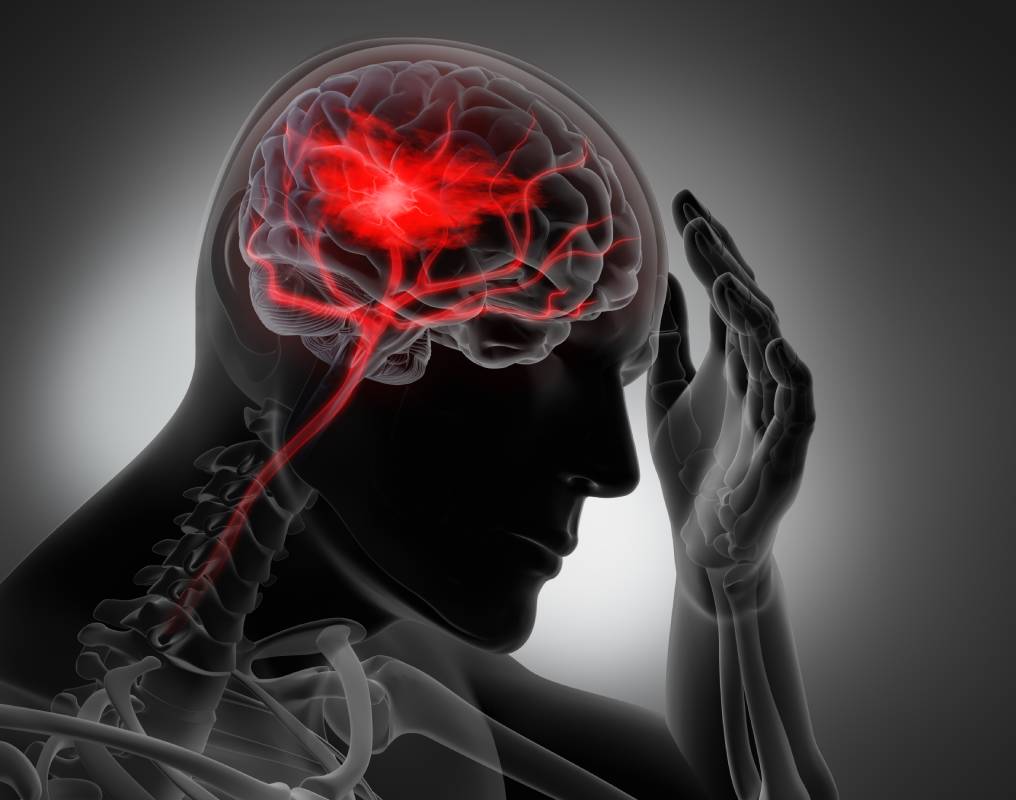 Mechanism of Amnesia Caused by Midazolam