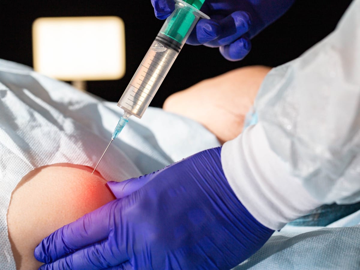 Superior Trunk Block in Regional Anesthesia